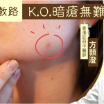 【中醫教路】日日戴口罩搞到生瘡? — K.O.暗瘡無難度