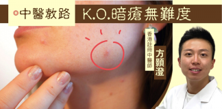 【中醫教路】日日戴口罩搞到生瘡? — K.O.暗瘡無難度