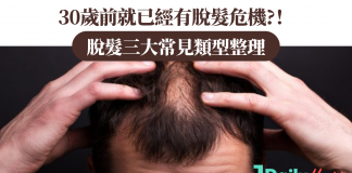 30歲前就已經有脫髮危機?!脫髮三大常見類型整理
