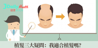 植髮三大疑問:我適合植髮嗎?植髮原理大拆解